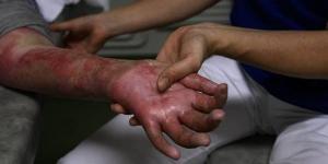 اعترافات صادمة لسائق بسوهاج: سكبت البنزين وأشعلت النار في خصمي بسبب خلافات عائلية