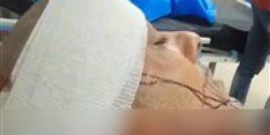 محاولة سرقة تنتهي بجريمة طعن.. إصابة شاب بـ21 غرزة والمتهم ما زال هاربًا ويُهدد المجني عليه