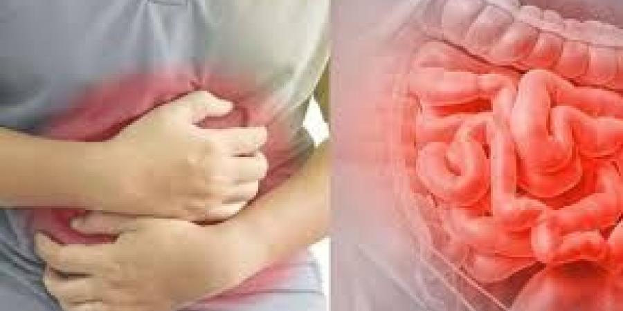 الشوكولاتة والثوم .. أطعمة تعزز صحة الأمعاء